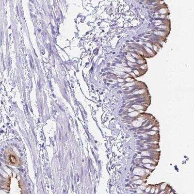 Immunohistochemistry-Paraffin: TCTEX1D4 Antibody [NBP2-32366]