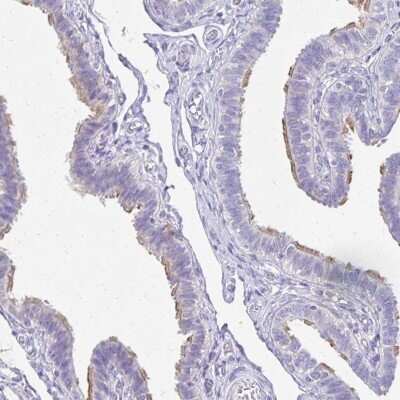 Immunohistochemistry-Paraffin: TCTEX1D4 Antibody [NBP2-32366]