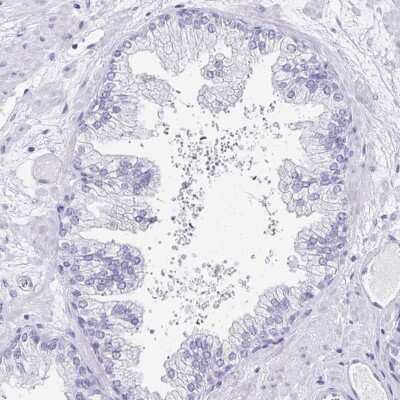 Immunohistochemistry-Paraffin: TCTEX1D4 Antibody [NBP2-32366]