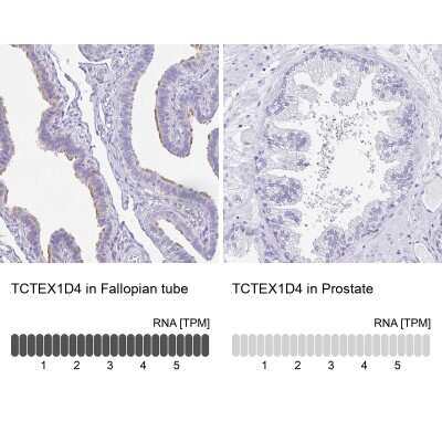 Immunohistochemistry-Paraffin: TCTEX1D4 Antibody [NBP2-32366]