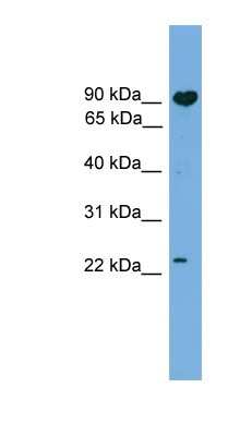 Western Blot: TCTEX1D4 Antibody [NBP1-70719]