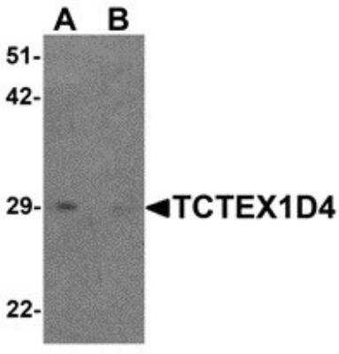 Western Blot: TCTEX1D4 AntibodyBSA Free [NBP2-81863]