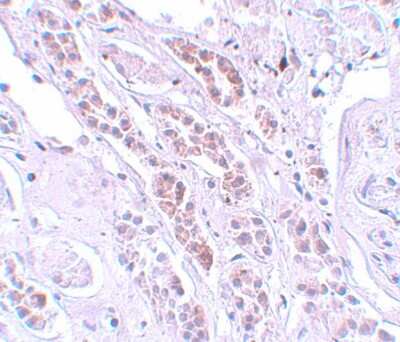 Immunohistochemistry-Paraffin: TCTN1 Antibody - BSA Free [NBP1-77182]