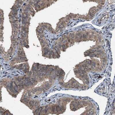 Immunohistochemistry-Paraffin: TCTN1 Antibody [NBP1-83624]