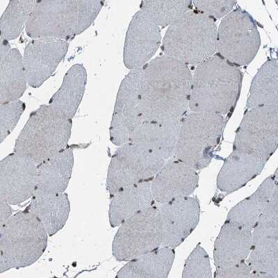 Immunohistochemistry-Paraffin: TCTN1 Antibody [NBP1-83624]