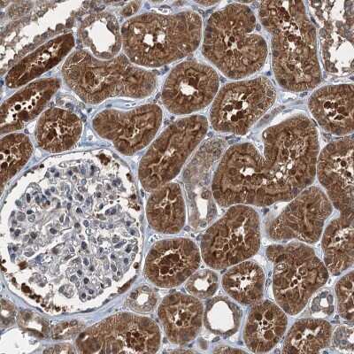 Immunohistochemistry-Paraffin: TCTN1 Antibody [NBP1-83624]