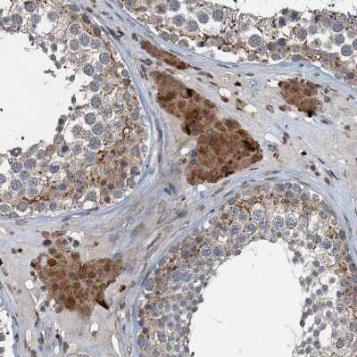 Immunohistochemistry-Paraffin: TCTN1 Antibody [NBP1-83624]