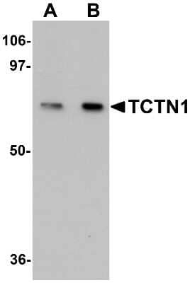 Western Blot: TCTN1 AntibodyBSA Free [NBP1-77182]