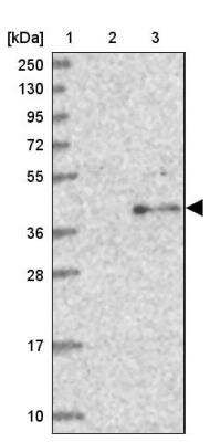 Western Blot: TCTN1 Antibody [NBP1-83623]