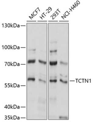 Western Blot: TCTN1 AntibodyAzide and BSA Free [NBP2-94021]