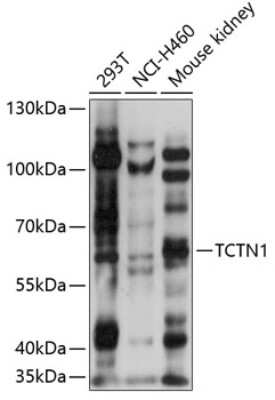 Western Blot: TCTN1 AntibodyAzide and BSA Free [NBP2-94088]