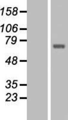 Western Blot: TCTN1 Overexpression Lysate [NBL1-16793]