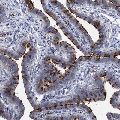 Immunohistochemistry-Paraffin: TCTN2 Antibody [NBP1-88392]