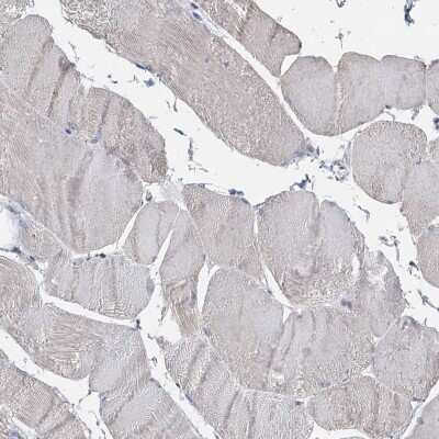 Immunohistochemistry-Paraffin: TCTN2 Antibody [NBP1-88392]