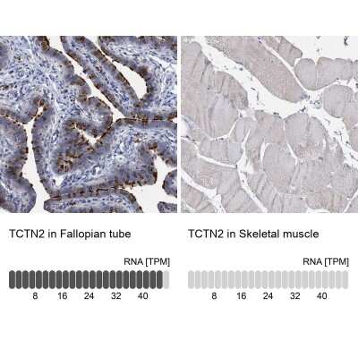 Immunohistochemistry-Paraffin: TCTN2 Antibody [NBP1-88392]