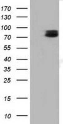 Western Blot: TCTN2 Antibody (OTI1C1)Azide and BSA Free [NBP2-74483]