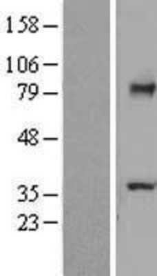 Western Blot: TCTN2 Overexpression Lysate [NBL1-16795]