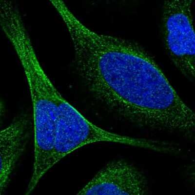 Immunocytochemistry/ Immunofluorescence: TCTN3 Antibody [NBP1-88537]