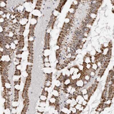 Immunohistochemistry-Paraffin: TCTN3 Antibody [NBP1-88537]