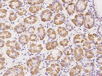 Immunohistochemistry-Paraffin: TCTN3 Antibody [NBP2-97323]