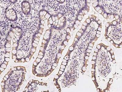 Immunohistochemistry-Paraffin: TCTN3 Antibody [NBP2-97323]