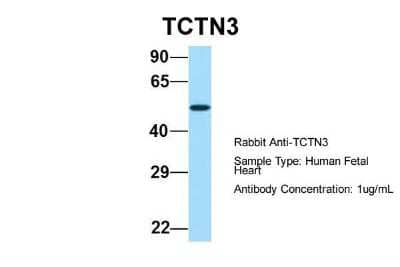 Western Blot: TCTN3 Antibody [NBP1-59741]