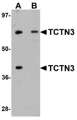 Western Blot: TCTN3 AntibodyBSA Free [NBP1-77183]