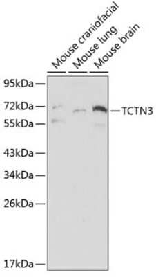 Western Blot: TCTN3 AntibodyBSA Free [NBP2-95116]