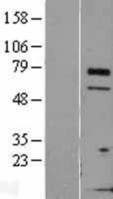 Western Blot: TCTN3 Overexpression Lysate [NBL1-16796]