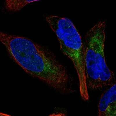 Immunocytochemistry/ Immunofluorescence: TDAG8/GPR65 Antibody [NBP2-58485]