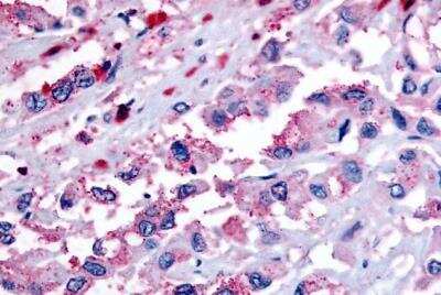 Immunohistochemistry-Paraffin: TDAG8/GPR65 Antibody - BSA Free [NLS1625]