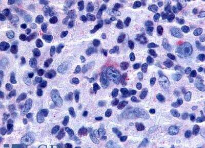 Immunohistochemistry-Paraffin: TDAG8/GPR65 Antibody - BSA Free [NLS1627]