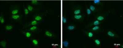 Immunocytochemistry/ Immunofluorescence: TDG Antibody (1142) [NBP2-43595]