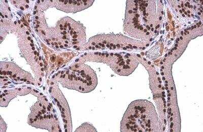 Immunohistochemistry-Paraffin: TDG Antibody (1511) [NBP2-43718]
