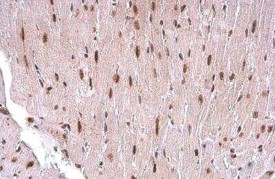 Immunohistochemistry-Paraffin: TDG Antibody (1511) [NBP2-43718]