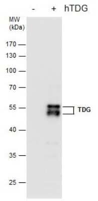 Western Blot: TDG Antibody (1511) [NBP2-43718]