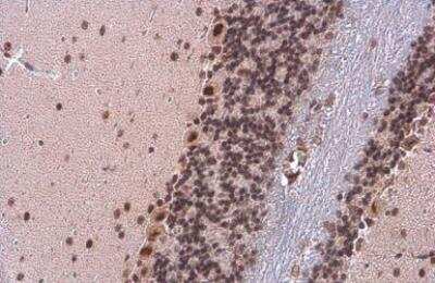Immunohistochemistry-Paraffin: TDG Antibody (311) [NBP2-43802]