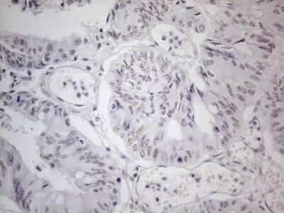 Immunohistochemistry: TDG Antibody (OTI3C11) [NBP2-46091]
