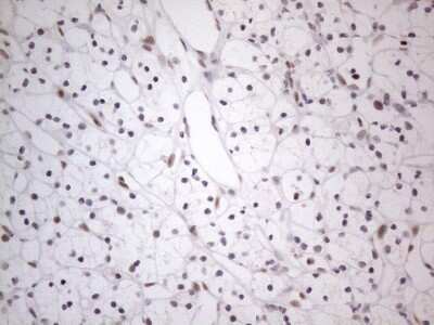 Immunohistochemistry: TDG Antibody (OTI3C11) [NBP2-46091]