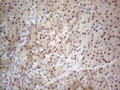 Immunohistochemistry: TDG Antibody (OTI3C11) [NBP2-46091]