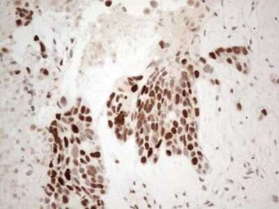 Immunohistochemistry: TDG Antibody (OTI3C11) [NBP2-46091]