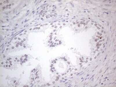 Immunohistochemistry: TDG Antibody (OTI3C11) [NBP2-46091]