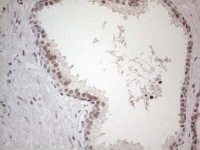 Immunohistochemistry: TDG Antibody (OTI3C11) [NBP2-46091]