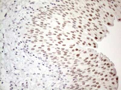 Immunohistochemistry: TDG Antibody (OTI3C11) [NBP2-46091]