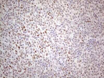 Immunohistochemistry: TDG Antibody (OTI3C11) [NBP2-46091]