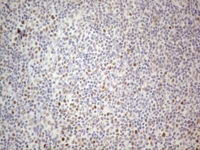 Immunohistochemistry: TDG Antibody (OTI3C11) [NBP2-46091]