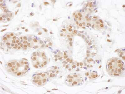 Immunohistochemistry-Paraffin: TDG Antibody [NBP2-32248]