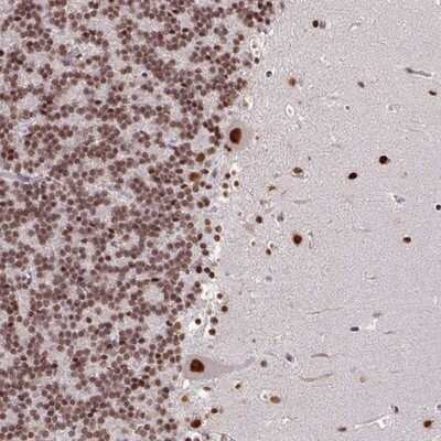 Immunohistochemistry-Paraffin: TDG Antibody [NBP2-13423]