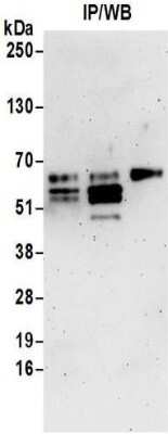 Immunoprecipitation: TDG Antibody [NBP2-32248]