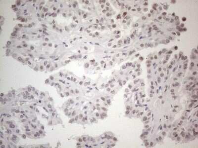 Immunohistochemistry: TDG Antibody (OTI3C11) - Azide and BSA Free [NBP2-74484]